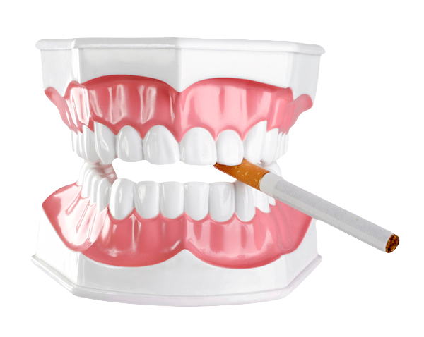 Denti e fumo